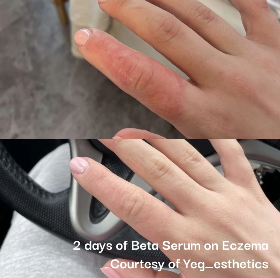 Beta-Glucan Serum